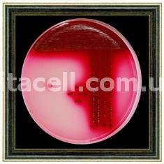 2.Escherichia_coli.jpg