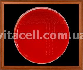 4.Acinetobacter.jpg